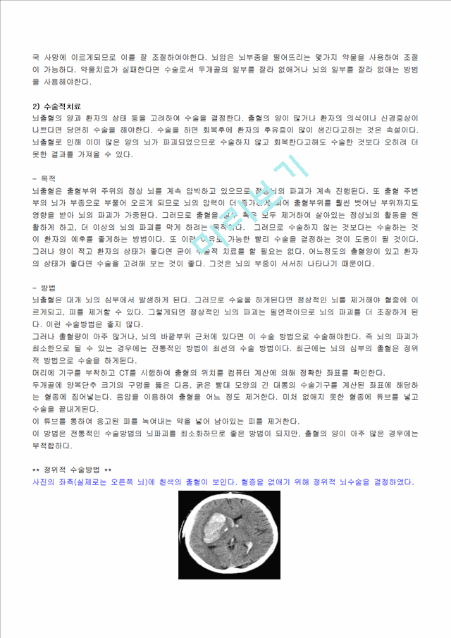 ICH-Intracerebral hemorrhage   (3 )